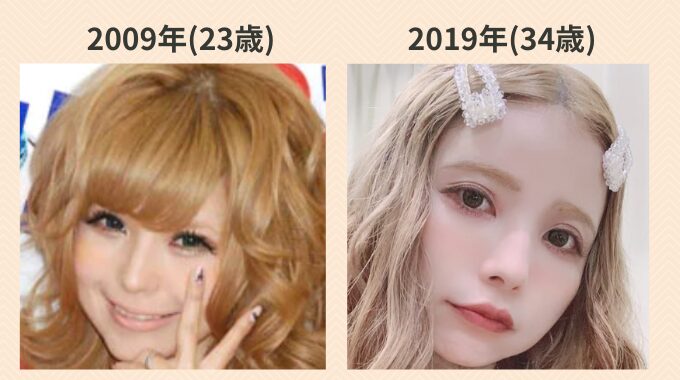 益若つばさの鼻は整形?