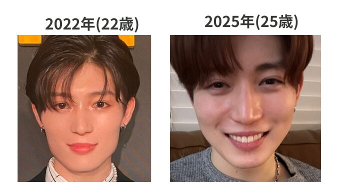 西山智樹は整形してる?