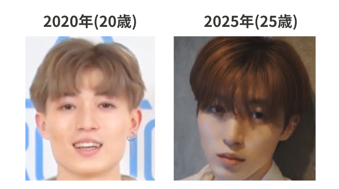 西山智樹は整形してる?